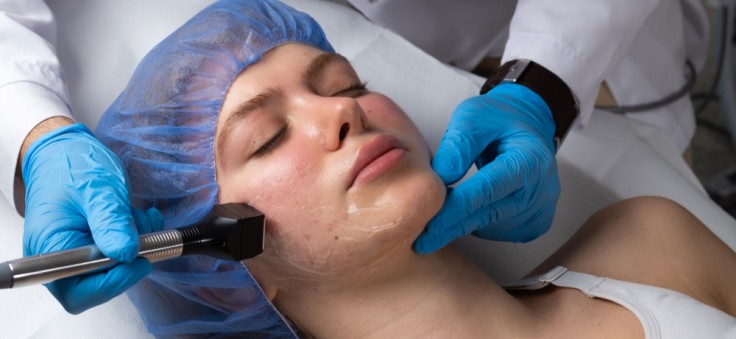 Everything You Need to Know About Skin Tightening