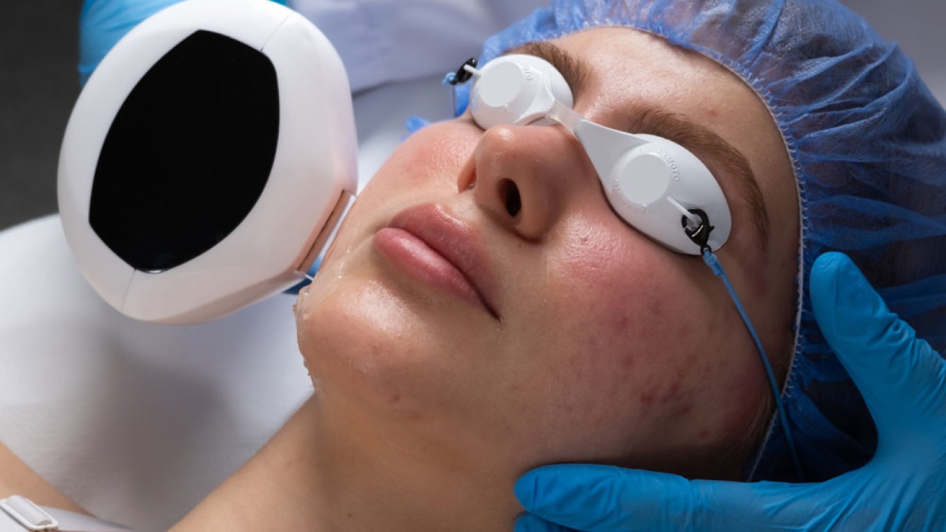 How to Get Rid of Hyperpigmentation?