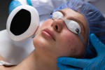 How to Get Rid of Hyperpigmentation?