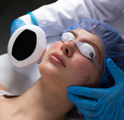 Skin Treatments