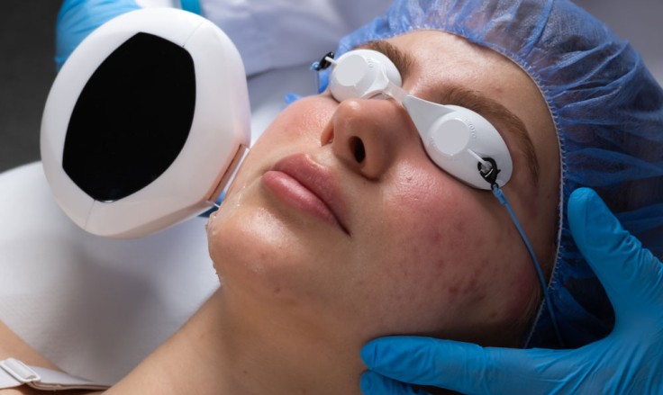 How to Get Rid of Hyperpigmentation?