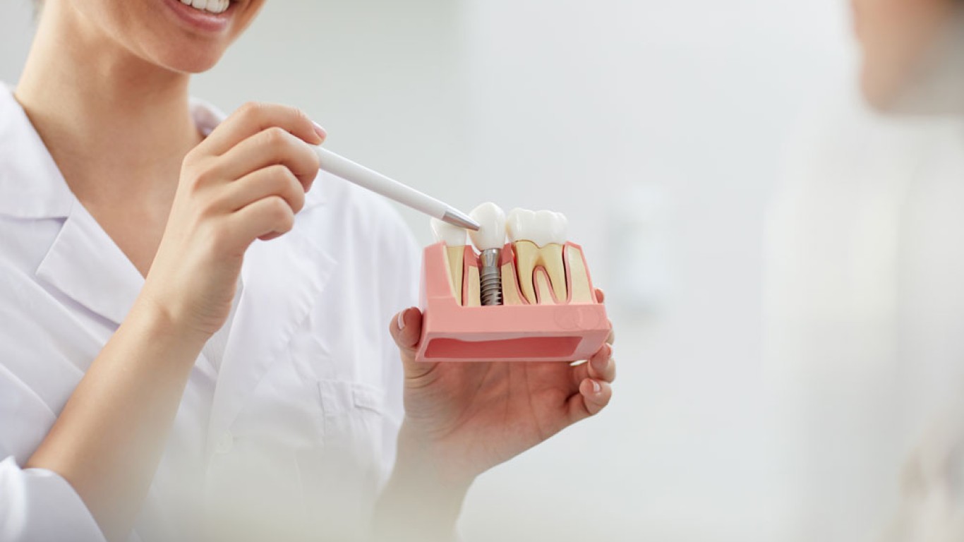 7 Things To Know Before Getting Teeth Implants