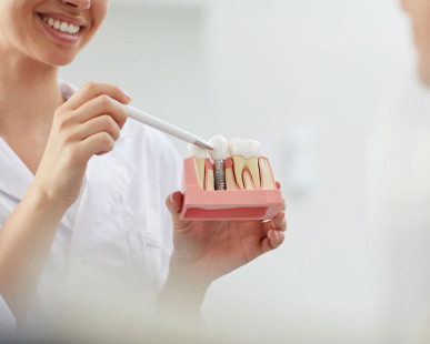 7 Things To Know Before Getting Teeth Implants