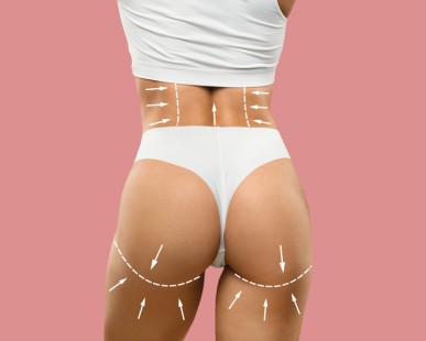 Thigh Lift Surgery (Thighplasty) in Turkey: Procedure, Cost