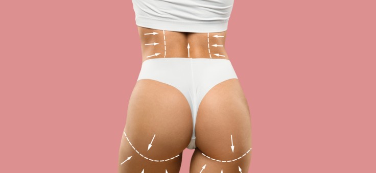 Thigh Lift Surgery (Thighplasty) in Turkey: Procedure, Cost