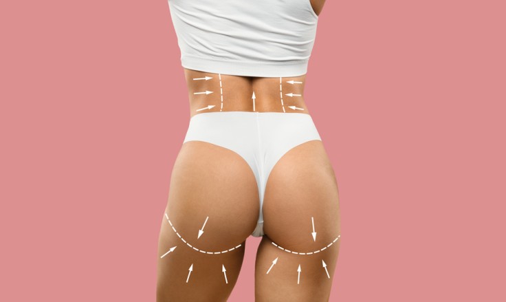 Thigh Lift Surgery (Thighplasty) in Turkey: Procedure, Cost