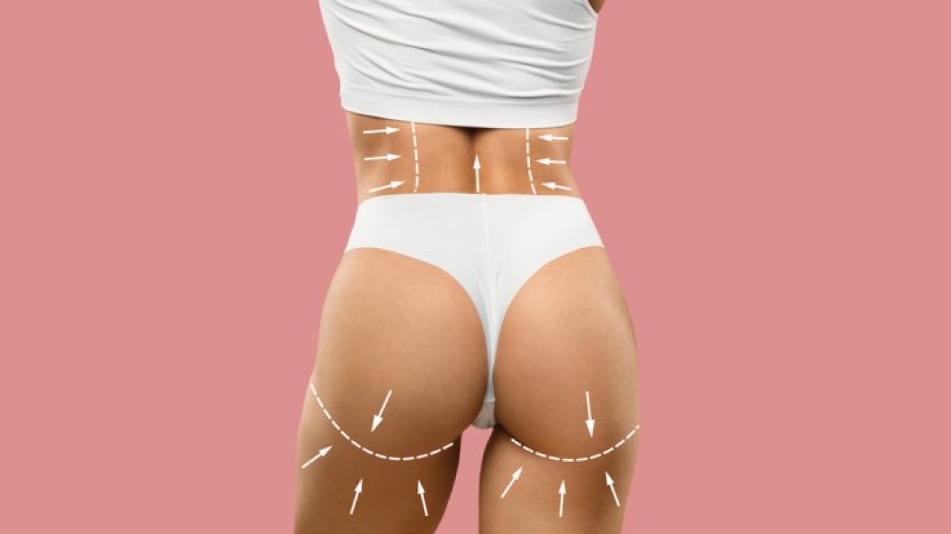 Liposuccion des cuisses en Turquie : à quoi s'attendre, procédure, coût