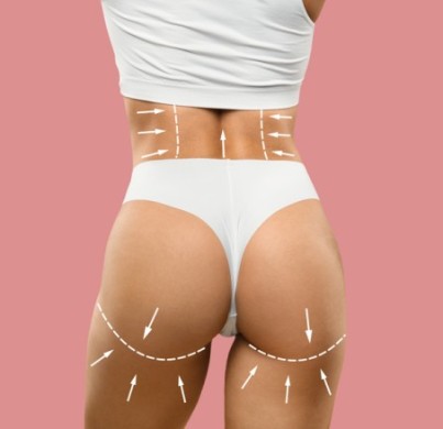Liposuccion des cuisses en Turquie : à quoi s'attendre, procédure, coût