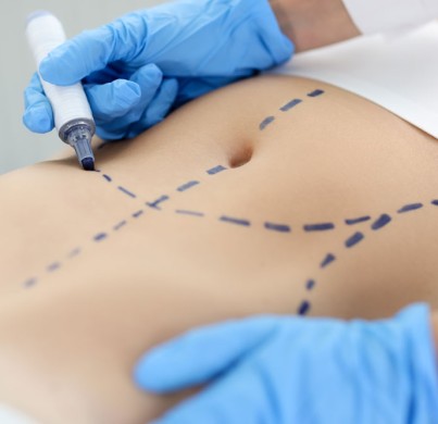 5 Reasons Abdominoplasty Patients Choose Turkey for Surgery