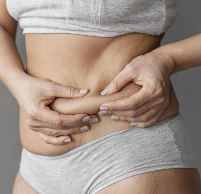 ¿Necesitas reparación muscular en una abdominoplastia?