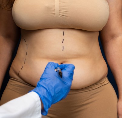 Les tarifs de l'abdominoplastie en Turquie
