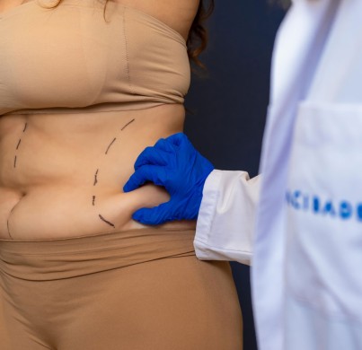 Cirugía bariátrica VS. Medicamentos para perder peso. ¿Cuál es la mejor opción?