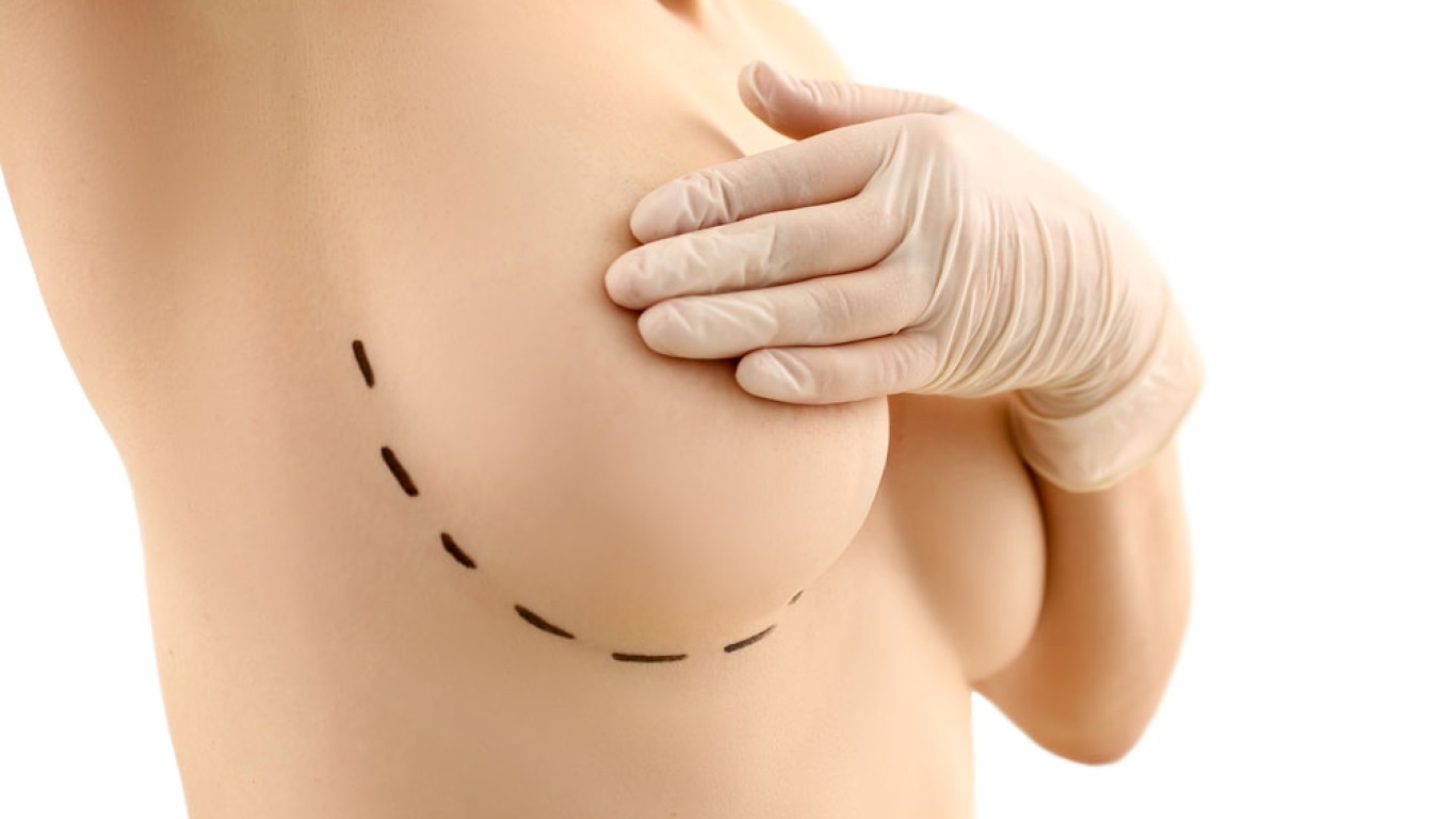 What to Expect from Breast Implant Surgery