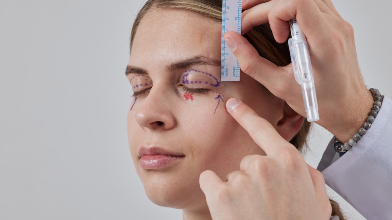 Upper Blepharoplasty: What is it, Cost, Procedure