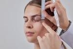 La blépharoplastie supérieure : explication, coût et déroulement