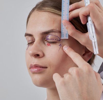 Blepharoplastik der Oberlider: Verfahren, Kosten, Ablauf