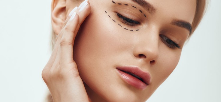 Upper Blepharoplasty in Turkey: What is it, Cost, Procedure