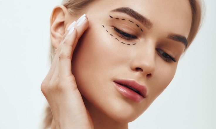Upper Blepharoplasty in Turkey: What is it, Cost, Procedure