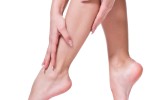 Spider Vein Removal: Laser vs Injection Compared