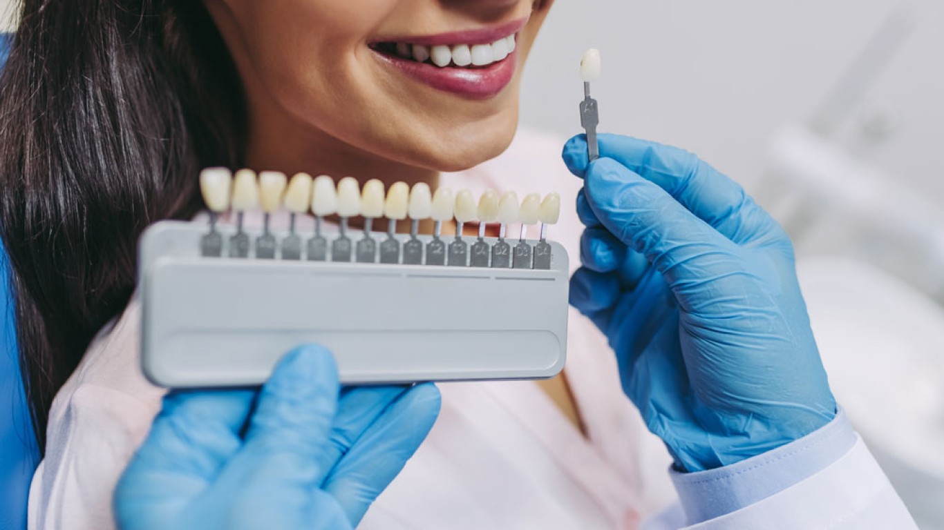 Everything You Need to Know About Composite Veneers
