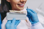 Everything You Need to Know About Composite Veneers