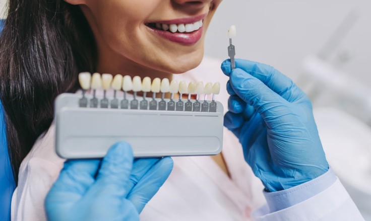 Everything You Need to Know About Composite Veneers