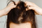 Hair Transplant for Women in Turkey: Types, Cost, Procedure