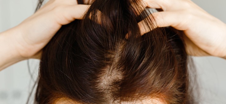 Haartransplantation für Frauen in der Türkei: Arten, Kosten, Verfahren 