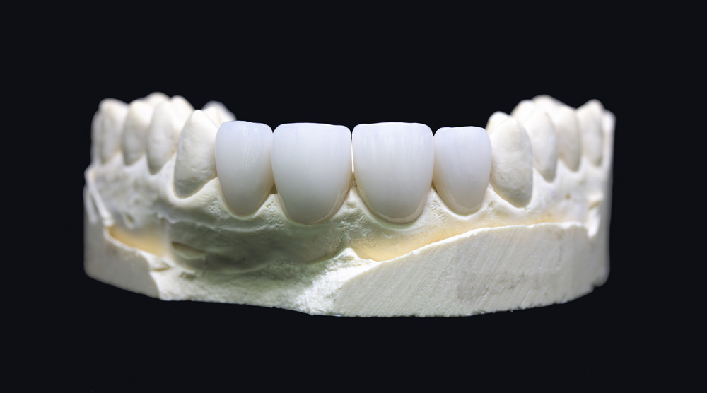 Zirconium Crowns Turkey cost