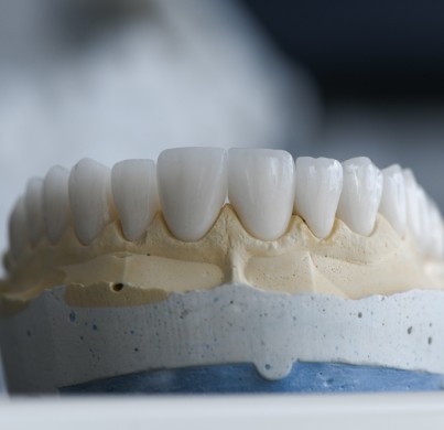 Coronas de zirconio en Turquía: qué son, precio y procedimiento