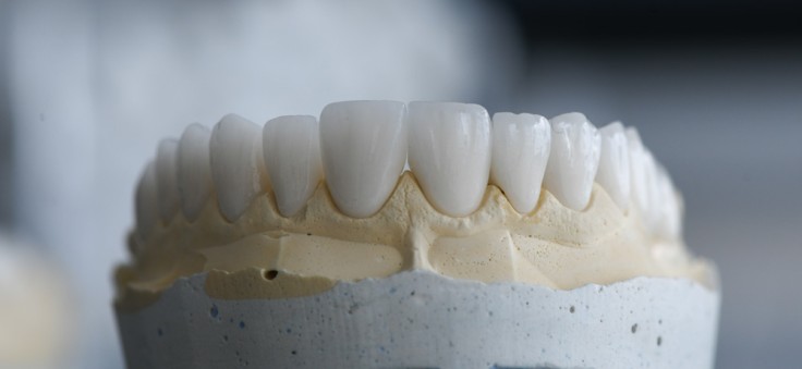 Zirconium Crowns in Turkey: What is it, Cost, Procedure
