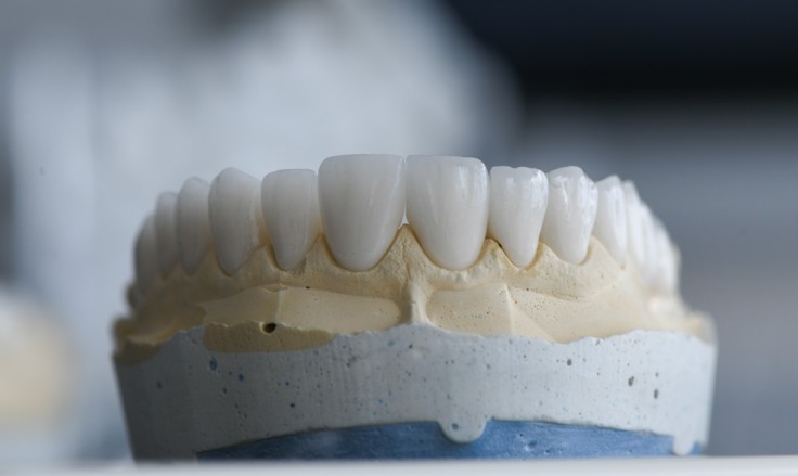 Zirconium Crowns in Turkey: What is it, Cost, Procedure